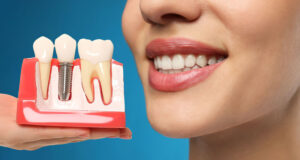 A woman smiles, holding a dental implant model showing the post and crown, emphasizing the natural, restored look and aesthetic benefits.